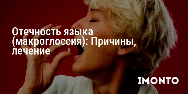 Отечность языка (макроглоссия): Причины, лечение