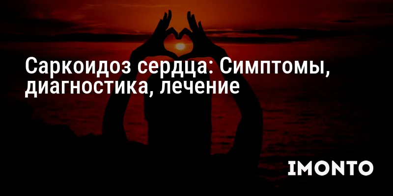 Саркоидоз сердца: Симптомы, диагностика, лечение